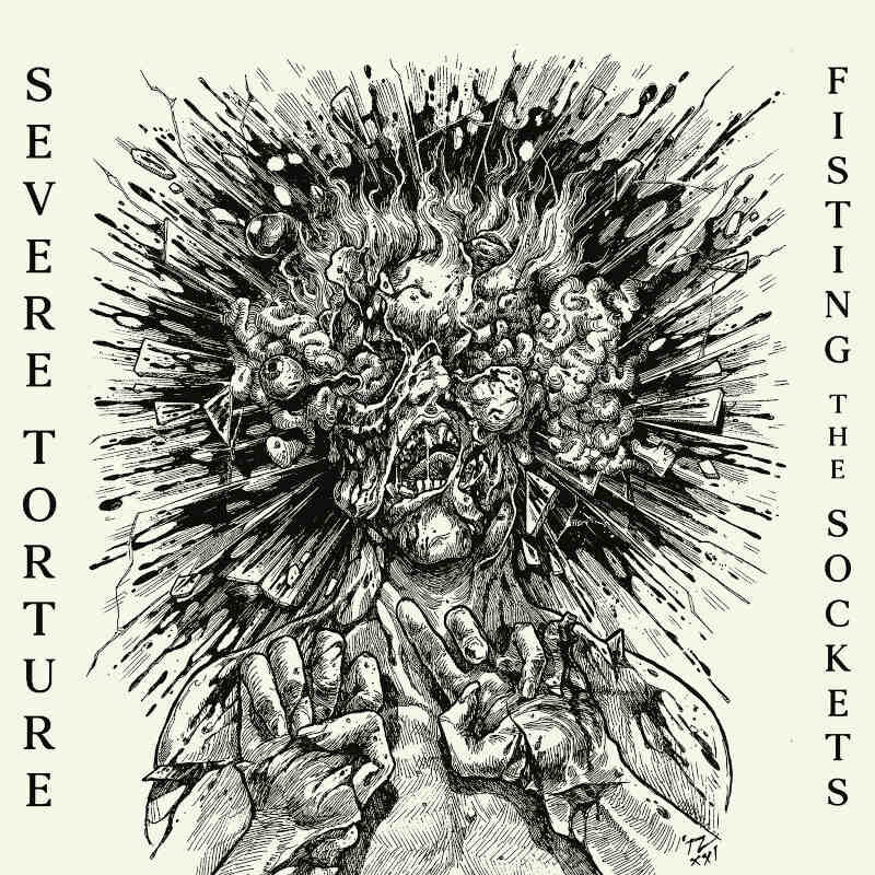 Severe